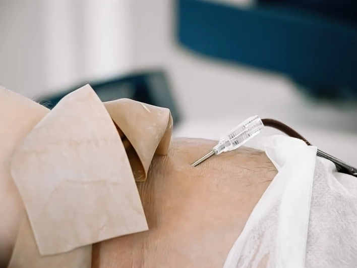 Professional service work by Premier Injury Specialists in Stockbridge